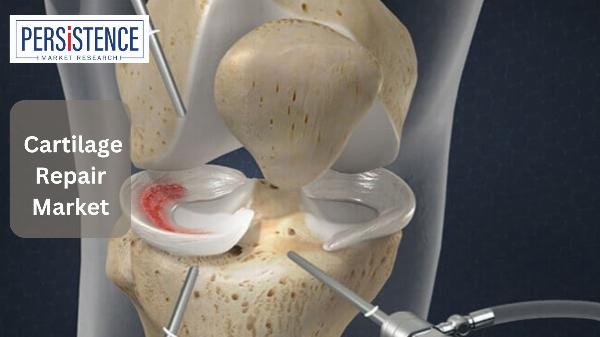 Cartilage Repair Market Future Outlook and Emerging Trends