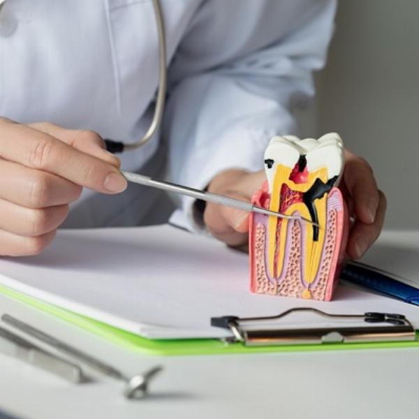 What Is the Maximum Age for Root Canal Treatment in Islamabad?