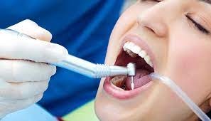 The Importance of Regular Teeth Cleaning for Optimal Oral Health