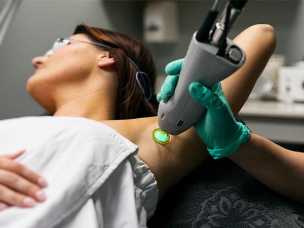 What Are the Side Effects of Electrolysis Hair Removal?
