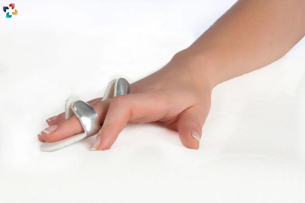 Finger Sprains: Ligament Injuries in the Fingers