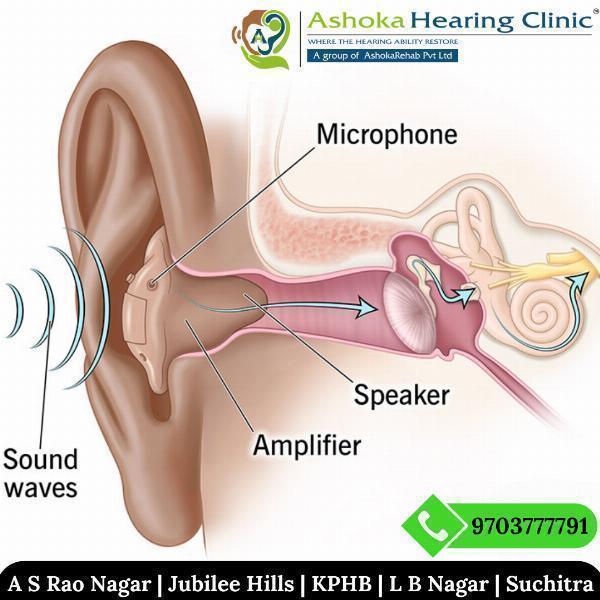 Best Hearing Clinic in Hyd