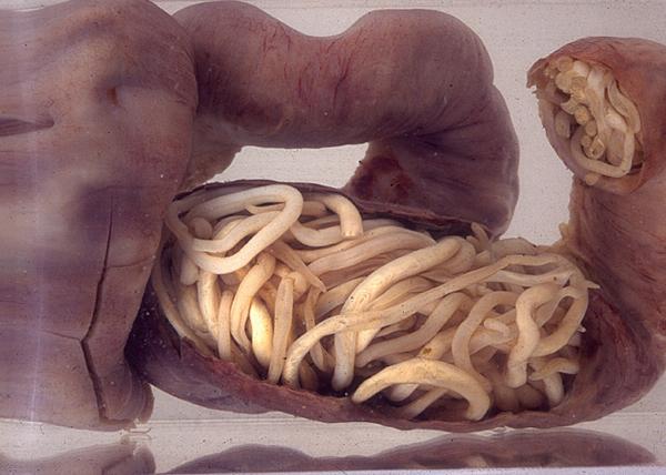 Stay Safe From Parasitic Worms While Traveling