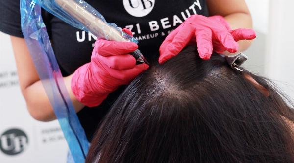 The Ultimate Guide to Scalp Micropigmentation for Women