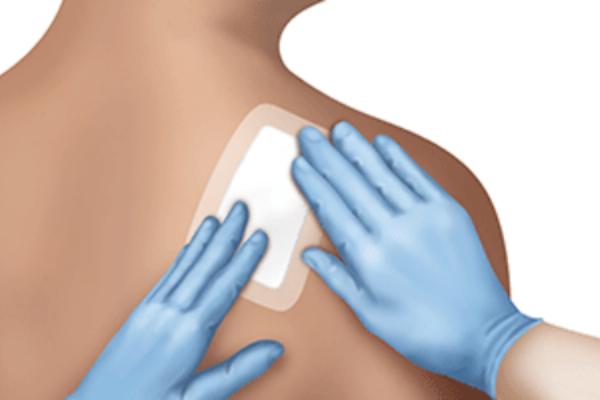 Biopsy for Diagnosis The Foundation of Effective Treatment