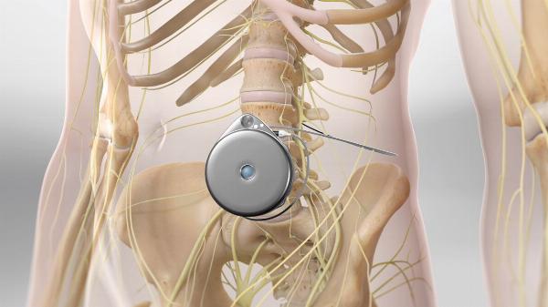 Intrathecal Therapy Market Emerging Trends, Future Demands by 2032