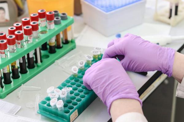 The Importance of Accurate HIV Testing in Lab Services