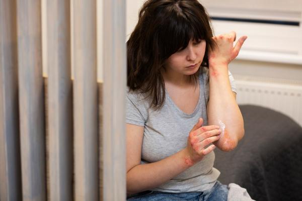 Preventing and Healing Burns: Tips for Safe Practices
