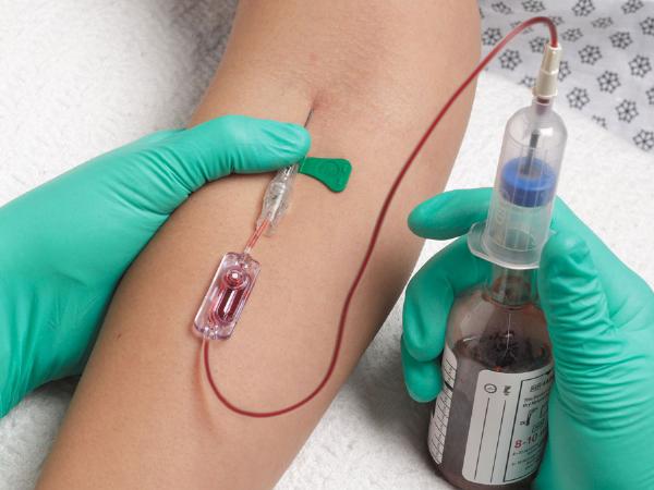 Blood Culture Test Market Size, Share, Growth, Opportunities and Global Forecast to 2032