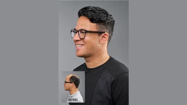 How to Swim or Exercise with a Men’s Hairpiece