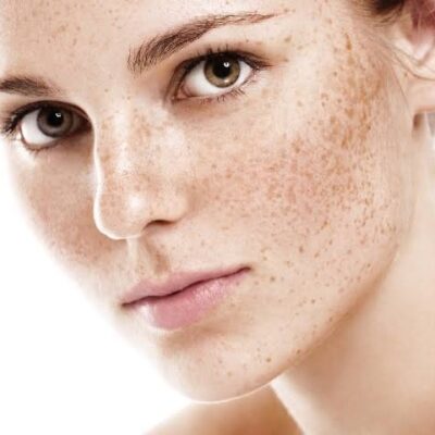 Understanding Dermal Pigmentation: Causes and Solutions