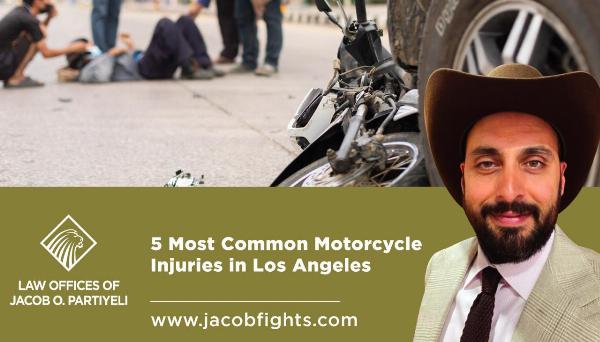 5 Most Common Motorcycle Injuries in Los Angeles