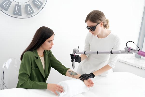 Experience Freedom with Laser Tattoo Removal