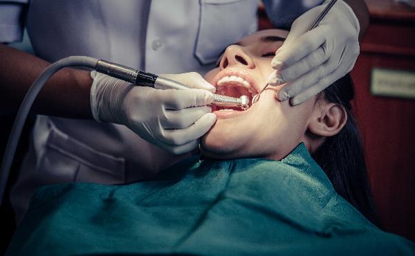 Do's and Don'ts After Tooth Filling: Essential Care Tips for a Healthy Smile