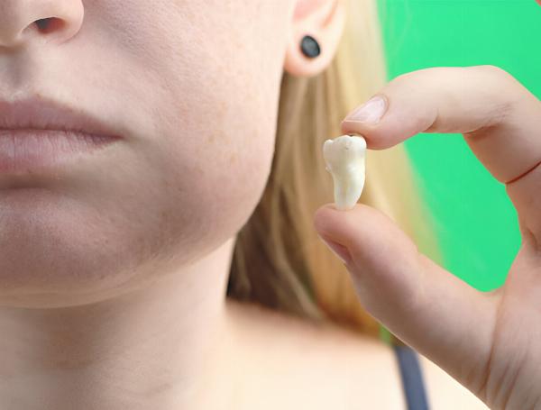 The Oral Health Benefits of Tooth Extractions