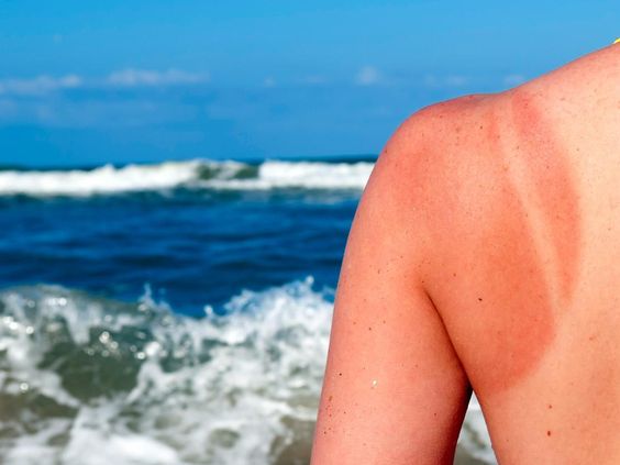 Elevate Your Skincare Routine with Tan Removal Treatments