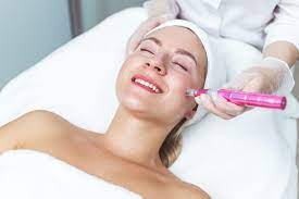 Experience the Power of Microneedling Treatment