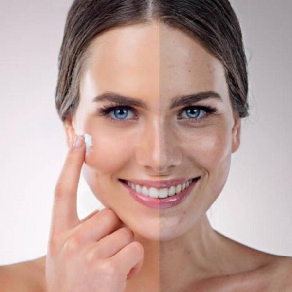 Understanding the Cost Range for Permanent Skin Whitening Injections