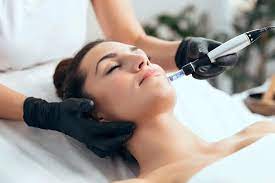 Microneedling: The Modern Solution for Skin Perfection