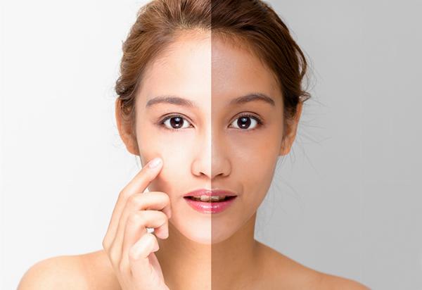 Understanding Neutro Skin Whitening Injections: Benefits, Risks, and Insights