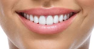 Introduction of e-Max Veneers
