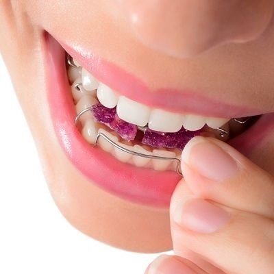 Innovative Dental Appliances for a Healthier Smile
