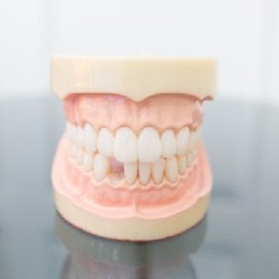 The Importance of Custom-Fit Dental Appliances for Optimal Results