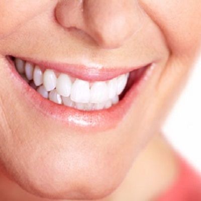 Comparing Home Teeth Whitening Strips and Gels: Which is Best?