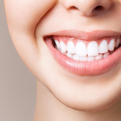 The Ultimate Guide to Home Teeth Whitening: Tips and Tricks