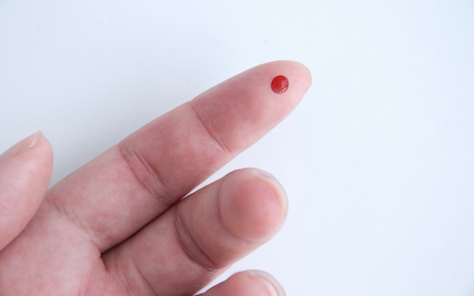 Affordable Blood Tests at Home: How to Save Money and Time