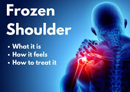Frozen Shoulder Treatment in Haryana: Dr. Manohar Kawariya's Expertise