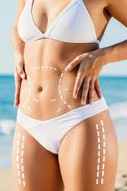 The Financial Breakdown: What Determines the Cost of Body Liposuction in Riyadh?