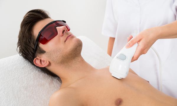 Laser Hair Removal for Men – 6 Facts to Know