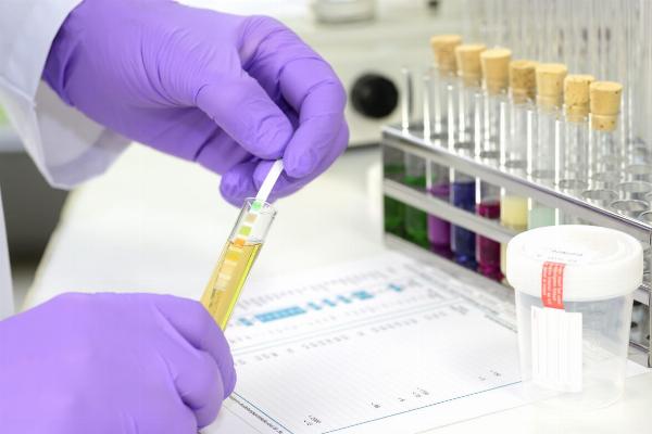 SWOT Analysis of the India Drug and Alcohol Screening Market
