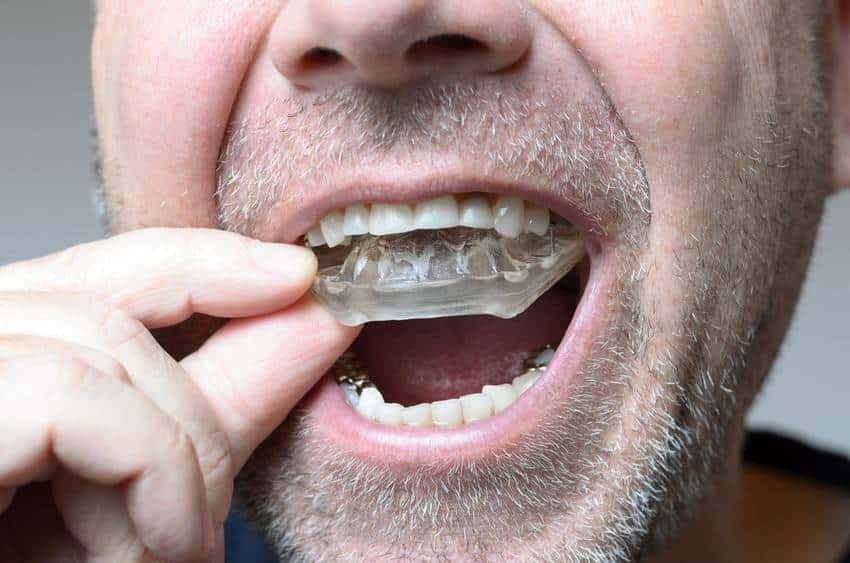 Dental Devices in Riyadh: Unlocking the Secrets to Perfect Oral Hygiene