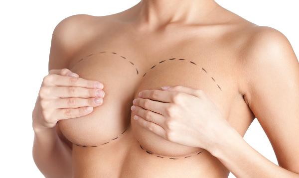 How to Maintain Long-Lasting Results After Breast Lift Surgery