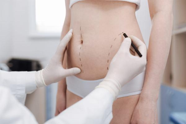 Liposuction Surgery in Dubai: A Comprehensive Comparison with Other Body Contouring Procedures