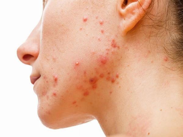 Topical Androgen Receptor Inhibitors Market Size, Industry, Trends 2032 | Reports and Insights