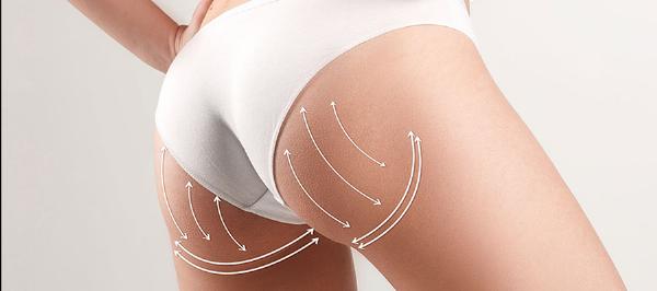 Redefine Your Silhouette: Benefits of a Buttock Lift