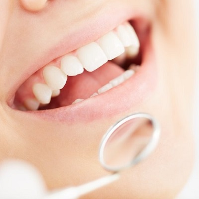 The Different Types of Dental Extractions: A Guide for Dubai Residents