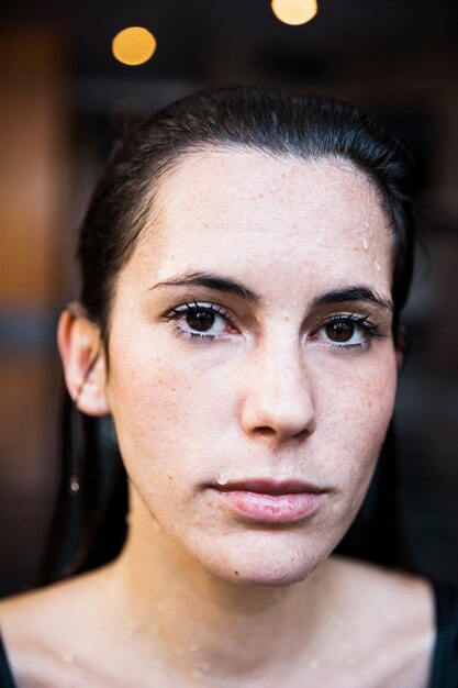 Melasma Treatment Strategies for Stunning Skin Revival