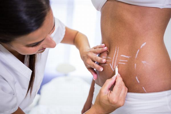 Mini Abdominoplasty: A Small Procedure with Big Impact