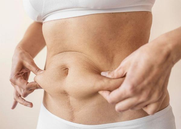 Enhancing Your Curves: The Benefits of Lipo Abdominoplasty