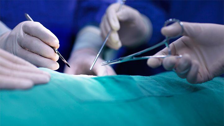 Appendix Removal Surgery: A Complete Guide