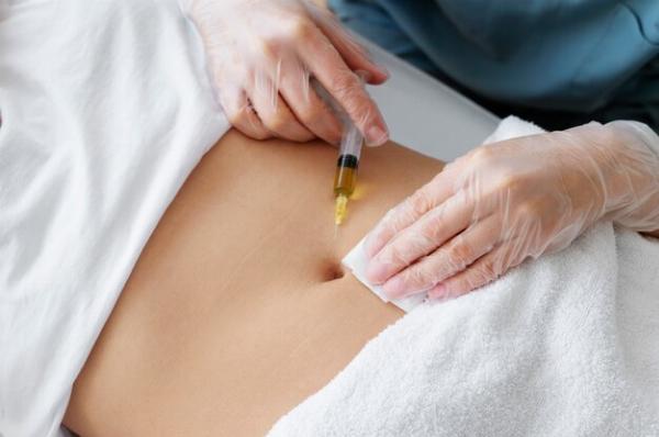 Achieving Your Dream Body: Tips for Post-Liposuction Care
