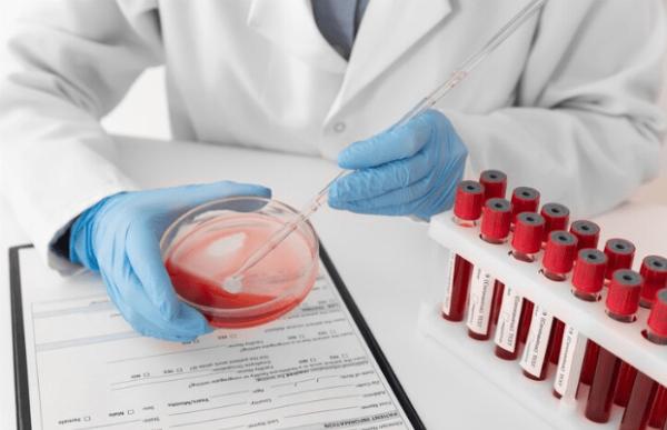 CBC Test: Why Your Doctor Recommends It and What to Expect