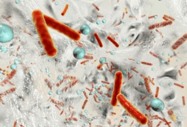 Biofilm Antimicrobial Susceptibility Testing to Tackle the Challenge of Biofilm-Associated Infections