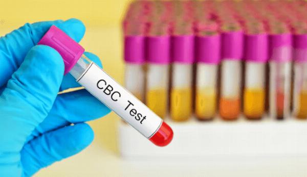 CBC Test: Normal Ranges and What Abnormal Results Mean