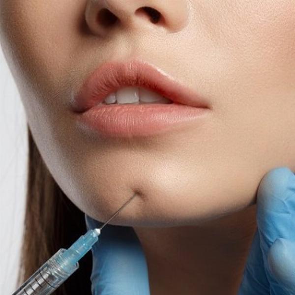 The Rise of Sculptra Fillers in Non-Surgical Facial Rejuvenation