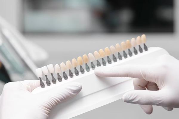 Exploring the Different Types of Composite Veneers for Broken Teeth in Dubai
